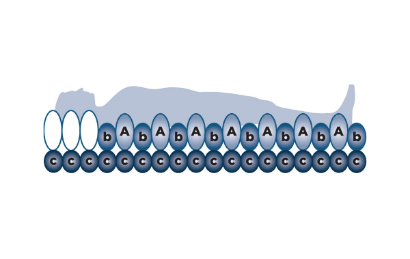 Picture of Alerta Ruby Auto Replacement Alternating